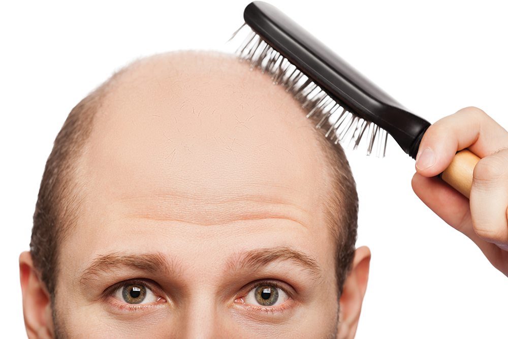Direct Hair Implantation (DHI) – Prime Clinics