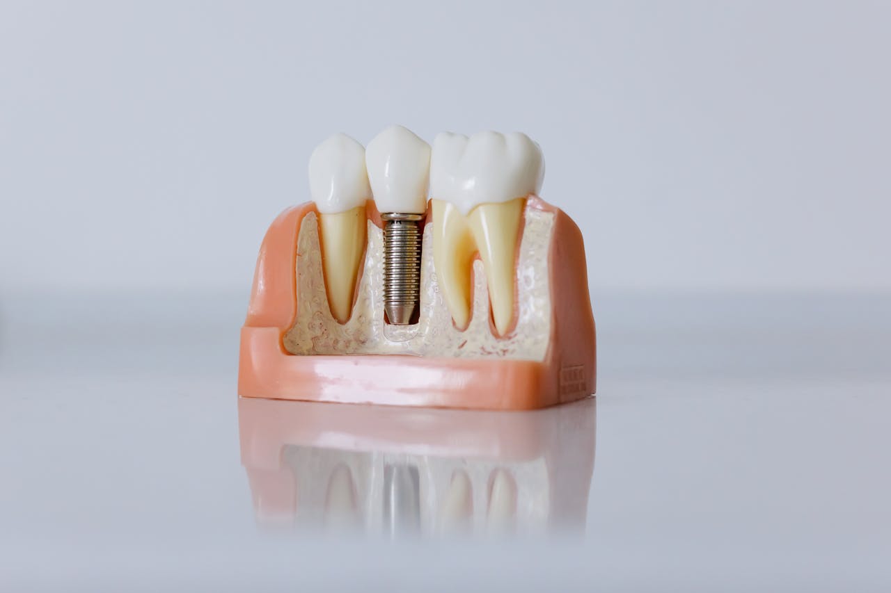 Slide Image