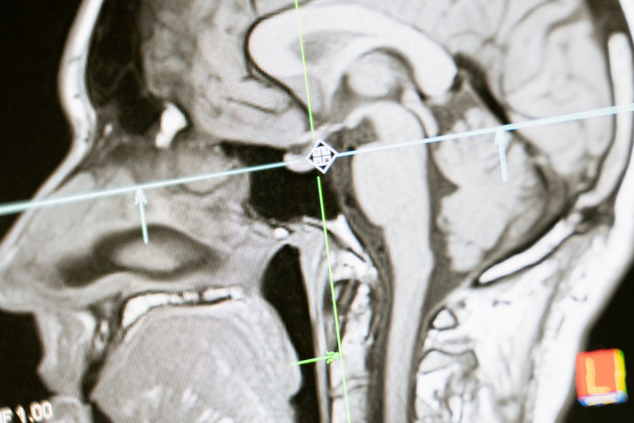 Slide Image